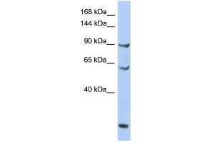 WB Suggested Anti-MCM8 Antibody Titration:  0. (MCM8 Antikörper  (N-Term))