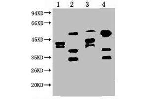 Western blot analysis of 1) Hela, 2) HepG2, 3) 293T, 4) Jurkat, diluted at 1:2000. (ERCC1 Antikörper)
