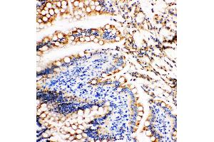 Anti-Vinculin antibody, IHC(P) IHC(P): Rat Intestine Tissue (Vinculin Antikörper  (N-Term))
