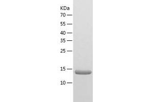 Western Blotting (WB) image for Aspartic Peptidase, Retroviral-Like 1 (ASPRV1) (AA 191-326) protein (His tag) (ABIN7121911) (ASPRV1 Protein (AA 191-326) (His tag))