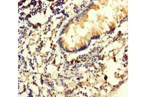 Immunohistochemistry of paraffin-embedded human appendix tissue using ABIN7170541 at dilution of 1:100 (Spermidine Synthase Antikörper  (AA 17-302))
