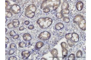 Immunoperoxidase of monoclonal antibody to OXSR1 on formalin-fixed paraffin-embedded human small Intestine. (OXSR1 Antikörper  (AA 1-527))