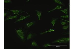 Immunofluorescence of purified MaxPab antibody to IMPA1 on HeLa cell. (IMPA1 Antikörper  (AA 1-277))