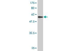 Western Blot detection against Immunogen (59. (ZNF215 Antikörper  (AA 1-304))