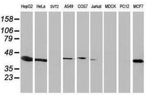 Image no. 2 for anti-ADP-Ribosylation Factor GTPase Activating Protein 1 (ARFGAP1) antibody (ABIN1496682) (ARFGAP1 Antikörper)