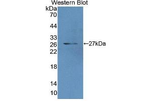 Figure. (MCCC2 Antikörper  (AA 337-563))