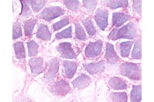 Anti-BDKRB2 / BK-2 antibody immunocytochemistry (ICC) staining of untransfected HEK293 human embryonic kidney cells. (BDKRB2 Antikörper  (C-Term))