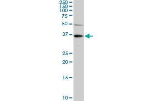 KLF7 monoclonal antibody (M01), clone 3E8-B8. (KLF7 Antikörper  (AA 1-230))