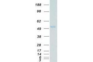Western Blotting (WB) image for Mitogen-Activated Protein Kinase 10 (MAPK10) (Transcript Variant 2) protein (Myc-DYKDDDDK Tag) (ABIN2725410)