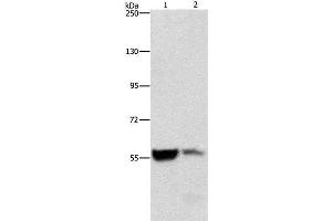 Western Blot analysis of Mouse liver and kidney tissue using ALDH8A1 Polyclonal Antibody at dilution of 1:550 (ALDH8A1 Antikörper)