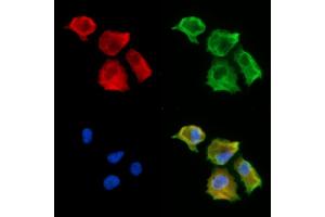 ABIN7094920 and ABIN7098976 staining  cells by IF/ICC.