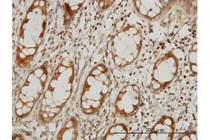 Image no. 1 for anti-Elongator Complex Protein 1 (ELP1) (AA 1242-1332) antibody (ABIN599043) (IKAP/p150 Antikörper  (AA 1242-1332))