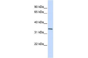 GNPDA1 antibody used at 1 ug/ml to detect target protein.