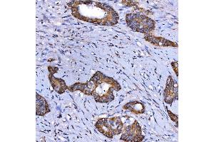 IHC analysis of SARS2 using anti-SARS2 antibody (ABIN7601804).