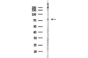 Western blot analysis of lysates from LoVo cells(heat-shock,45 min treatment), using Kv4.