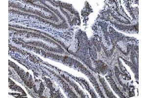 IHC analysis of MCM6 using anti-MCM6 antibody (ABIN7600036). (MCM6 Antikörper  (AA 14-821))
