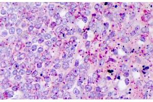 Anti-IL-17 antibody IHC staining of human t lymphocytes. (Interleukin 17a Antikörper)