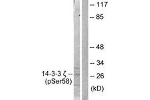 Western blot analysis of extracts from NIH-3T3 cells treated with UV 30', using 14-3-3 zeta (Phospho-Ser58) Antibody. (14-3-3 zeta Antikörper  (pSer58))