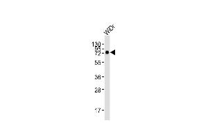 Anti-CD73 (NT5E) Antibody (C-term) at 1:2000 dilution + WiDr whole cell lysates Lysates/proteins at 20 μg per lane.