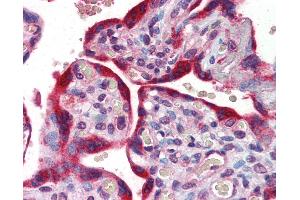 anti-ATP-Binding Cassette, Sub-Family B (MDR/TAP), Member 4 (ABCB4) (AA 252-301) antibody