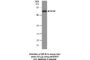 Image no. 1 for anti-Scavenger Receptor Class B, Member 1 (SCARB1) (C-Term) antibody (ABIN363331) (SCARB1 Antikörper  (C-Term))