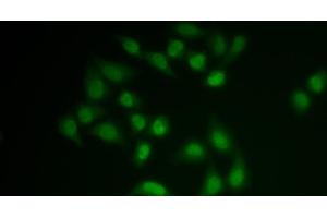 Immunofluorescence analysis of MCF-7 cells using CHAT Polyclonal Antibody (Choline Acetyltransferase Antikörper)