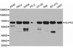 Western blot analysis of extracts of various cell lines, using NUP62 antibody. (NUP62 Antikörper  (AA 403-522))