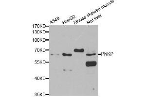Western blot analysis of extracts of various cell lines, using PNKP antibody. (PNKP Antikörper)