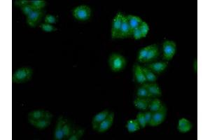 Immunofluorescence staining of HepG2 cells with ABIN7153741 at 1:105, counter-stained with DAPI. (ALG11 Antikörper  (AA 416-480))