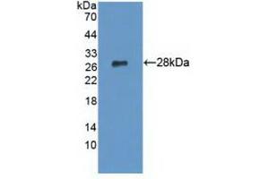 Figure. (LYPLA1 Antikörper  (AA 1-230))