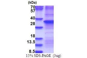 SDS-PAGE (SDS) image for Hepatocyte Growth Factor (Hepapoietin A, Scatter Factor) (HGF) (AA 32-285) protein (ABIN5853753)