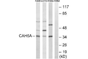 Western blot analysis of extracts from A549 cells, LOVO cells and K562 cells, using CA5A antibody. (CA5A Antikörper)