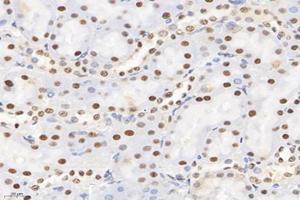 Immunohistochemistry analysis of paraffin-embedded rat kidney using,SET (ABIN7075583) at dilution of 1: 10000 (SET/TAF-I Antikörper)