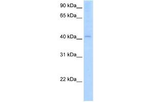 WB Suggested Anti-AADAC Antibody Titration:  2. (AADAC Antikörper  (C-Term))