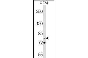ITGB2 Antibody (N-term) (ABIN1539259 and ABIN2849614) western blot analysis in CEM cell line lysates (35 μg/lane). (Integrin beta 2 Antikörper  (N-Term))