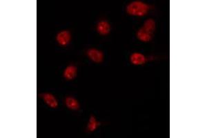 ABIN6266723 staining HT29 by IF/ICC. (T-Box 10 Antikörper  (Internal Region))