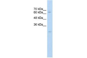 Carboxylesterase 2 antibody used at 0. (CES2 Antikörper)