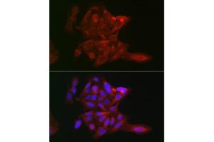 Immunofluorescence analysis of U-2 OS cells using LOX Rabbit pAb (ABIN6133805, ABIN6143288, ABIN6143289 and ABIN6223629) at dilution of 1:100 (40x lens). (LOX Antikörper)
