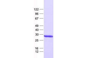 Validation with Western Blot (XRCC6BP1 Protein (His tag))