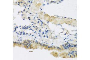 Immunohistochemistry of paraffin-embedded mouse lung using CLIP1 antibody (ABIN5975170) at dilution of 1/100 (40x lens). (CLIP1 Antikörper)