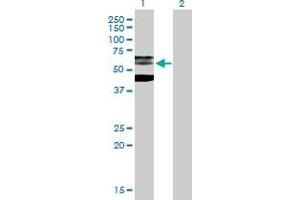 Western Blot analysis of PHF21B expression in transfected 293T cell line by PHF21B MaxPab polyclonal antibody. (PHF21B Antikörper  (AA 1-531))
