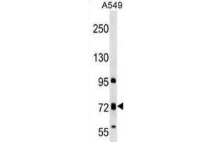 Western Blotting (WB) image for anti-Transmembrane Channel-Like 4 (Tmc4) antibody (ABIN2999757)