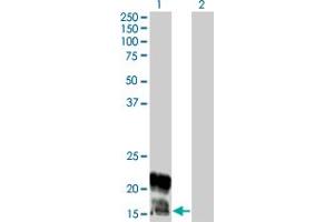 Western Blot analysis of KCNE1 expression in transfected 293T cell line by KCNE1 monoclonal antibody (M01), clone 5B12. (KCNE1 Antikörper  (AA 67-129))