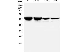 Western blot analysis of PTBP2 using anti-PTBP2 antibody (ABIN7599452).