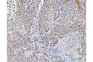 IHC analysis of GLIS1 using anti-GLIS1 antibody (ABIN7599501). (GLIS1 Antikörper  (AA 1-620))