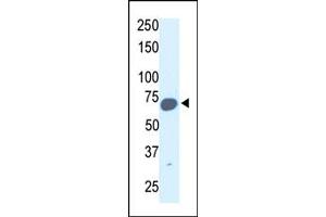 Image no. 1 for anti-Synovial Apoptosis Inhibitor 1, Synoviolin (SYVN1) (C-Term) antibody (ABIN357625) (SYVN1 Antikörper  (C-Term))