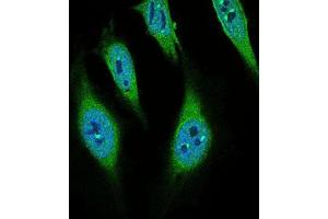 Immunofluorescence (IF) image for anti-CD68 Molecule (CD68) (AA 42-155) antibody (ABIN2682982)