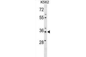 Western Blotting (WB) image for anti-PDZ and LIM Domain 4 (PDLIM4) antibody (ABIN2999859) (PDLIM4 Antikörper)