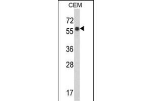 Western blot analysis of WDR1 Antibody (C-term) (ABIN389460 and ABIN2839527) in CEM cell line lysates (35 μg/lane). (WDR1 Antikörper  (C-Term))