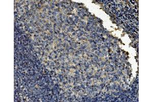 IHC analysis of Clathrin heavy chain/CLTC using anti-Clathrin heavy chain/CLTC antibody (ABIN7602703). (Clathrin Heavy Chain (CLTC) (AA 967-1668) Antikörper)